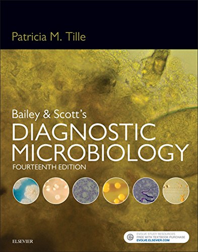 Bailey & Scott's Diagnostic Microbiology, 14th Edition By Patricia Tille 2015 Test Bank